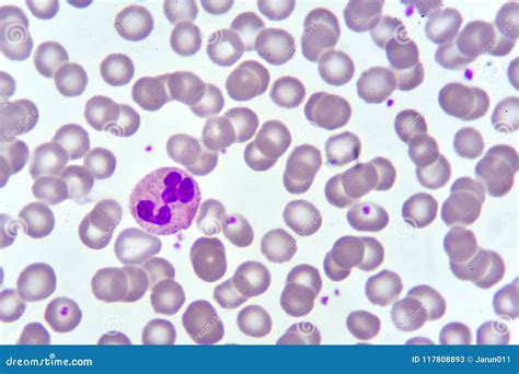 Monocyte And Neutrophil Cell In Blood Smear Royalty Free Stock Image