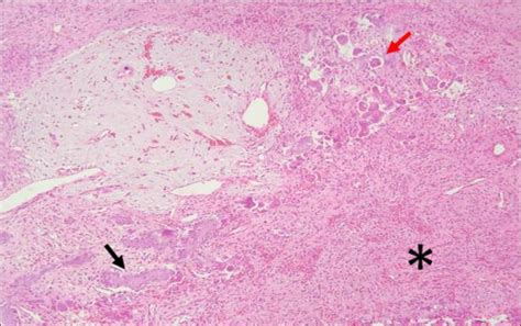 Oral Bone Photomicrograph Of A Dog Showing Intense Fibroplasia