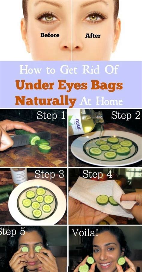 How To Get Rid Of Under Eye Bag Naturally Under Eye Bags