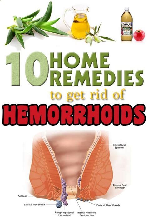 Cool How To Fix Hemorrhoids During Pregnancy 2022 Rawax