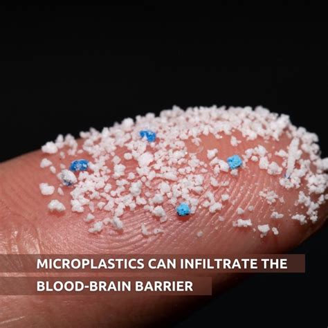 A New Study Has Shown How Microplastics Can Infiltrate The Blood Brain