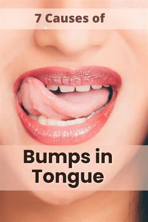 Causes Of Bumps In The Back Of Your Tongue Mg