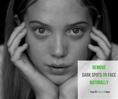 Top 10 Home Remedies To Get Rid Of Dark Spots On Face Top10 Natural