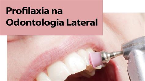 Profilaxia Na Odontologia Lateral Youtube