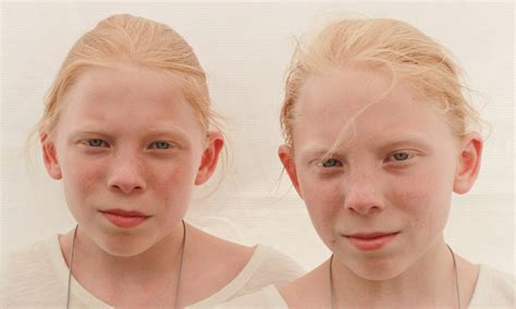 Identical Twins Are Genetically Different Research Suggests Daily
