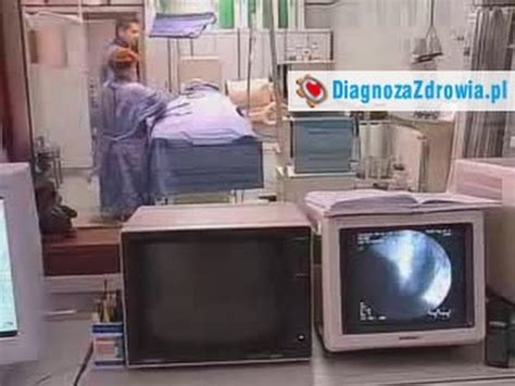 Kardiologia Stabilna Choroba Wie Cowa Przyczyny Objawy Leczenie Zwiastun Filmu Youtube