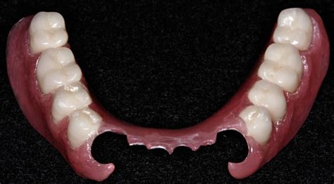 Partial Dentures Bottom Front Teeth