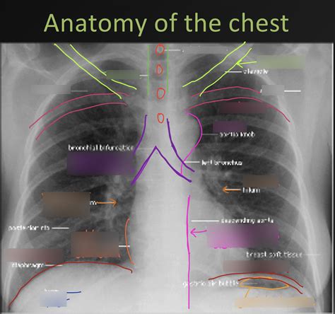 Anatomy Of The Chest Via Cxr Diagram Diagram Quizlet