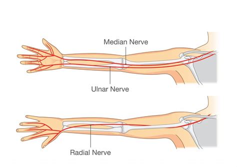 Management Of Pins And Needles And Numbness In The Upper Limbs And