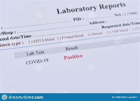 University health services and primary care sports medicine director dr. Positive Test Result Of COVID-19 Stock Photo - Image of ...