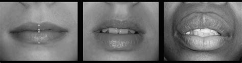 the aesthetics of ideal lips in men and women qoves