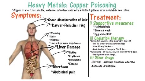 Copper Poisoning Youtube