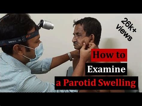 Clinical Examination Of A Parotid Gland Swelling Step By Step Demonstration YouTube