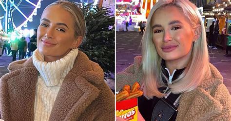 Molly Mae Hague Shares Incredible Transformation In Before And After Photos Of Fillers Daily