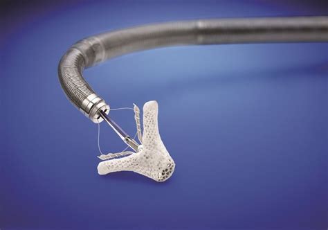 Transcatheter Mitral Valve Repair Device The Device Is Delivered By A
