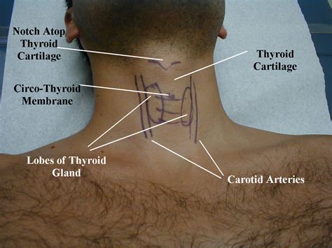 Diagram Lymph Nodes Back Neck