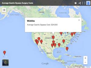 Stick to your dietary regimes and requirements, don't slip because you are on holiday. Weight Loss Surgery Costs, Insurance Coverage | Obesity Reporter