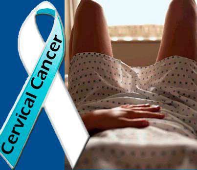 Cervical Cancer Life After Treatment In U K