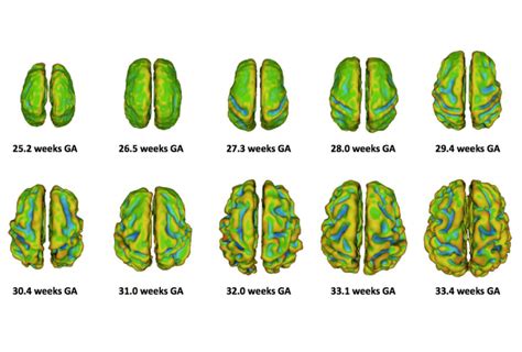 Brain Development In Womb