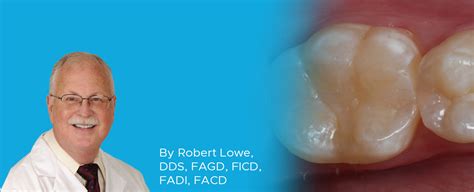 Dr Lowe Posterior Composite Resin Restoration Article Image Clinician S Choice Dental Products