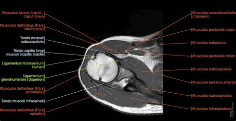 Mrt Der Schulter Normale Anatomie E Anatomy