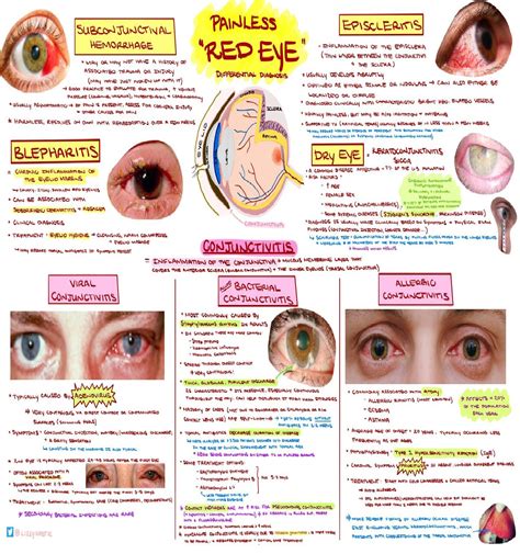 The Red Eye Emergency Medicine Kenya Foundation