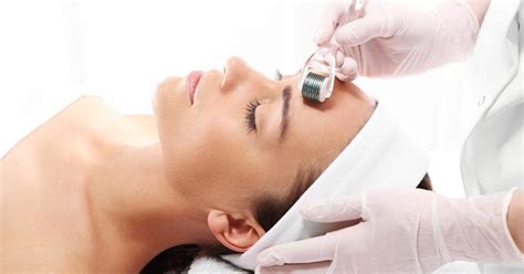 The Beauty Business By Jana Elston Is Micro Needling Better Than Chemical Peels