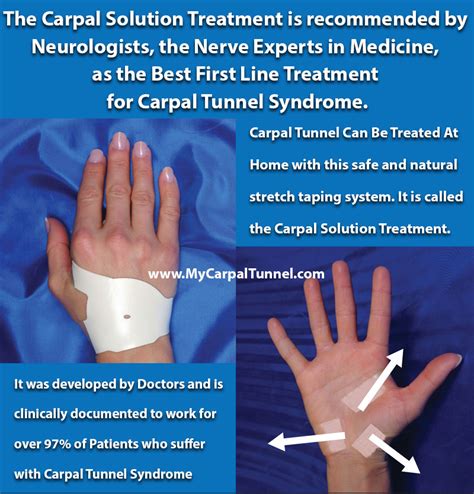 What Is The Best Natural Treatment For Carpal Tunnel