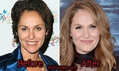 Amy Brenneman Plastic Surgery: Before After Botox, Boob Job Pictures