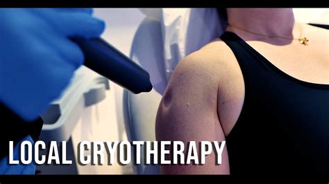 Localised Cryotherapy Reduce Inflammation Speed Up Recovery