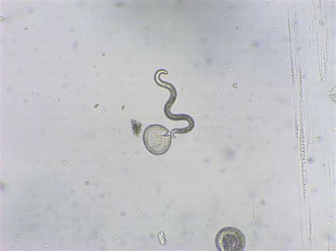 Toxocara Canis Second Stage Larvae Hatch From Eggs In Microscope My