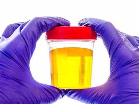 If you have been drinking more water than your body needs, the body tells the kidney filters to get rid of the spare water. Bright yellow urine: Colors, changes, and causes
