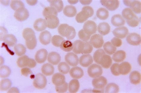 Free Picture Micrograph Growing Plasmodium Malariae Trophozoite