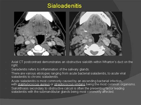 Pediatric Facial Swelling A Guide To Radiologic Diagnosis