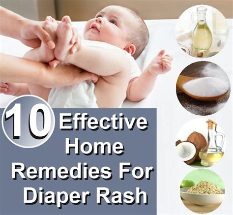 Top 10 Effective Home Remedies For Diaper Rash Health And Diy Home