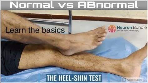 Heel To Toe Test