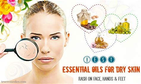 13 Best Essential Oils For Dry Skin On Face Hands And Feet