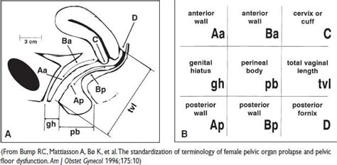 Surgery And Urogynecology Obgyn Key