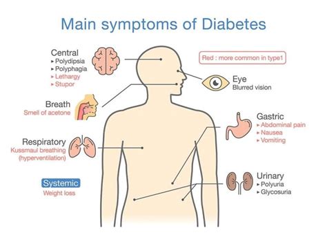 10 Silent Signs Of Type 1 Diabetes A2z Healthy