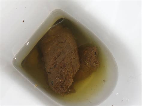 Is It Normal For Stool To Seep Color When Left In Toilet Bowl Askdocs