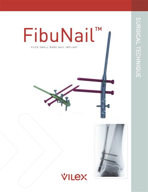 Fibunail Fibular Nailing System