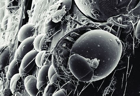 Scanning Electron Image Of Phoretic Mites On Dryocoetes Confusus