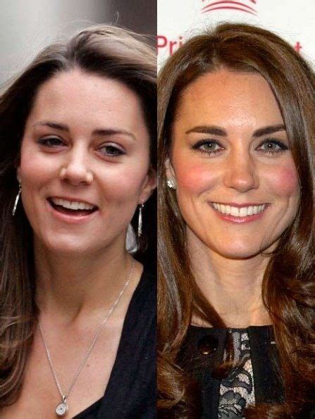 Kate Middleton In 2007 And Kate Middleton In December Of 2010 Just A