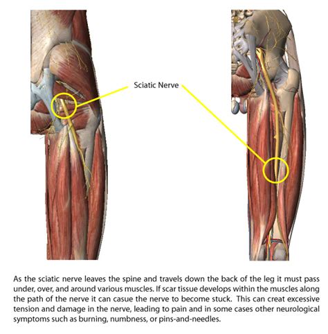 The sciatic nerve, also called the ischiadic nerve, is a large nerve in humans and other vertebrate animals which is the largest branch of the sacral plexus and runs alongside the hip joint and down the. Sciatic Nerve Path Diagram