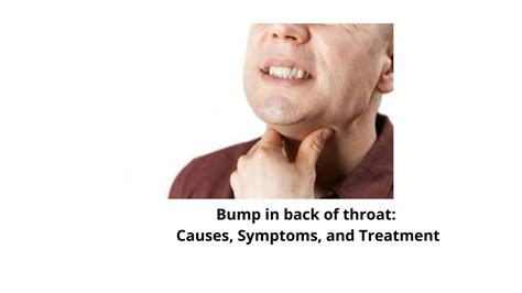 Bump In Back Of Throat Causes Symptoms And Treatment