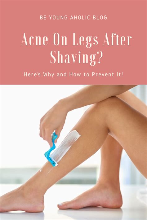 Acne On Legs After Shaving Heres Why And How To Prevent It