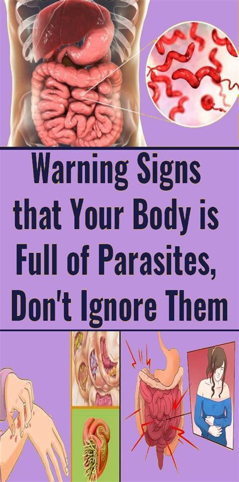 Parasite Symptoms In Humans Do You Have These Common Signs My Xxx Hot Girl