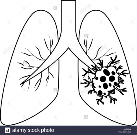 Lung Cancer Drawing At Getdrawings Free Download