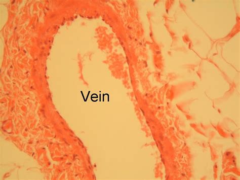 Wall structure of arteries and veins. Artery Under Microscope Labeled - Micropedia