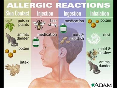 How To Get Rid Of Allergies Without Taking Medicine Top Home Remedies Hubpages